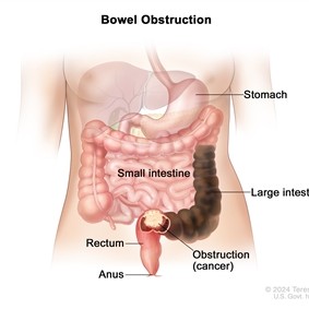 Created for the National Cancer Institute, http://www.cancer.gov